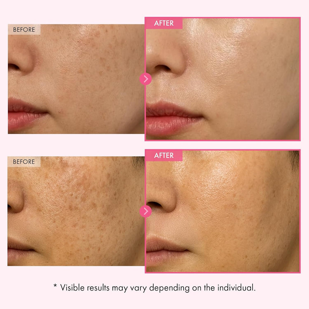Korean Advanced Arbutin Brightening Cream