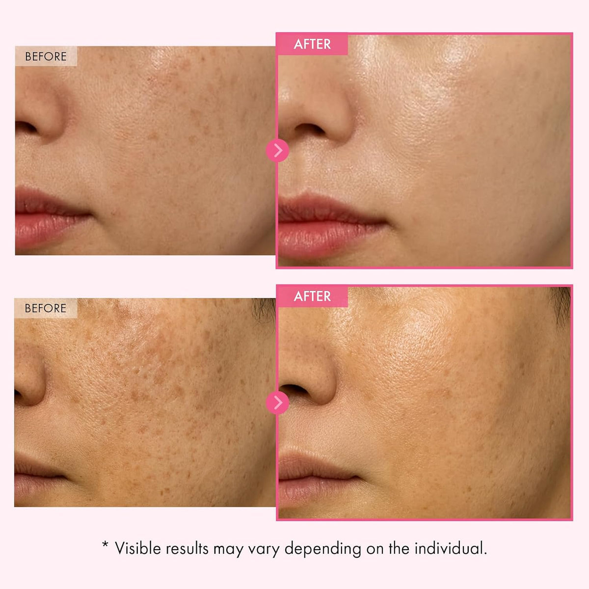 Korean Advanced Arbutin Brightening Cream