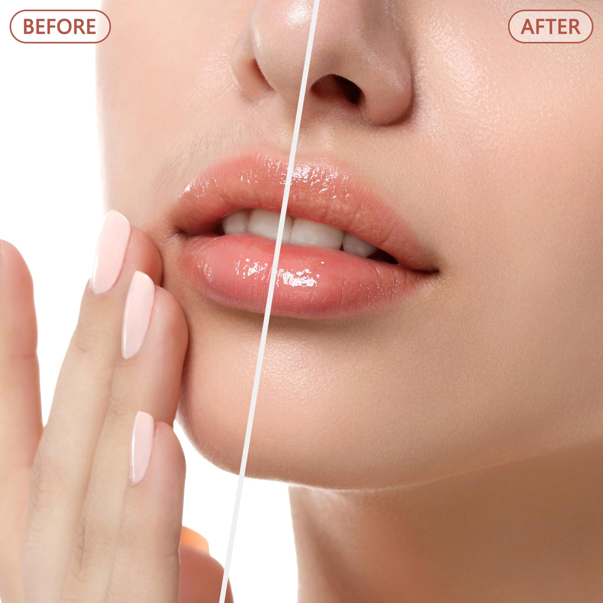 💥Best-Selling Facial Hair Remover For Women