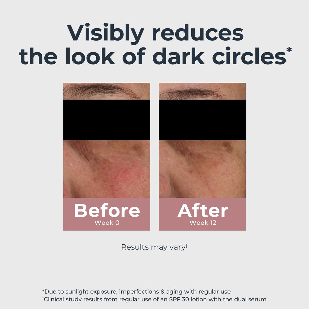 Eucerin Radiant Tone Eye Cream – Dark Circle Corrector